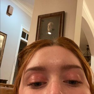 Meet your Posher, Willie